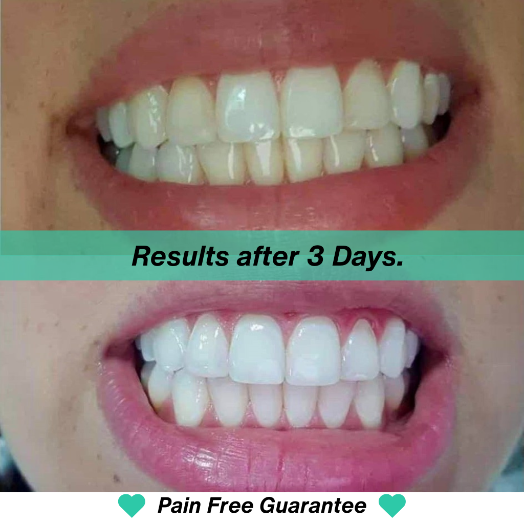Before and after comparison of teeth whitening results with text 'Results after 3 Days' and 'Pain Free Guarantee'.